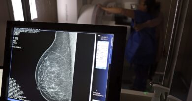 Cerca de 77 mil mulheres aguardam mamografia pelo SUS