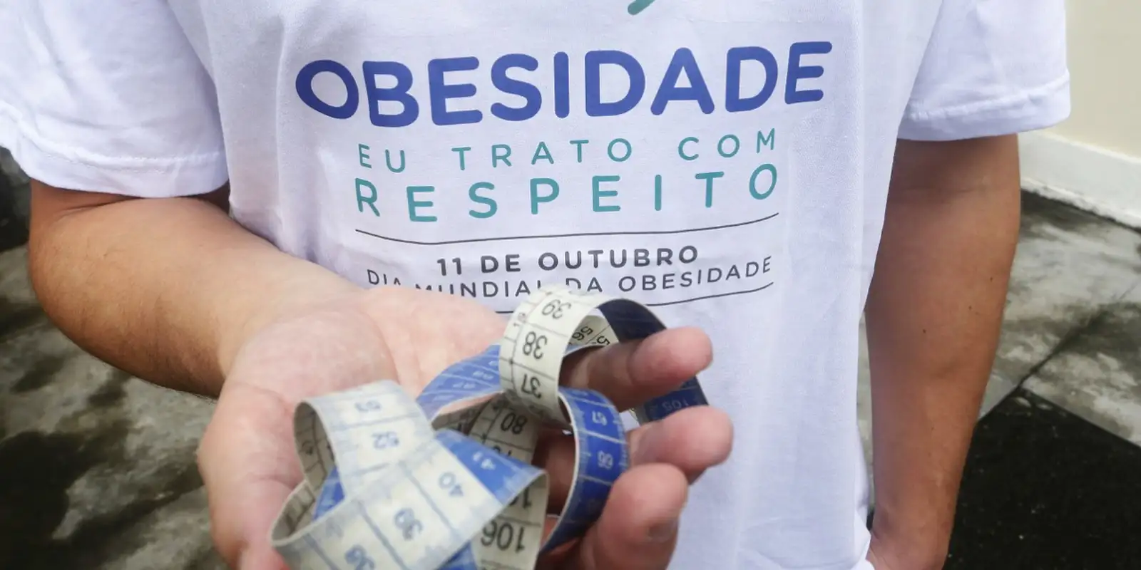 Adolescentes a partir dos 14 anos podem fazer cirurgia bariátrica