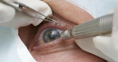 Cirurgia que altera cor do olho tem uso restrito para pessoas cegas