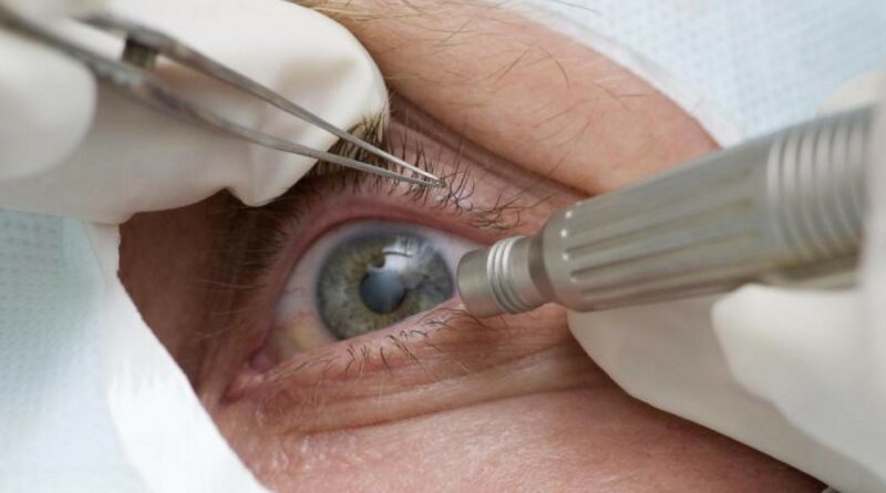 Cirurgia que altera cor do olho tem uso restrito para pessoas cegas