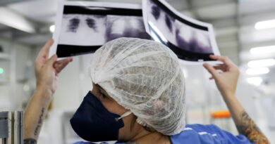 Câncer de pulmão: 15% dos casos acontecem em não fumantes