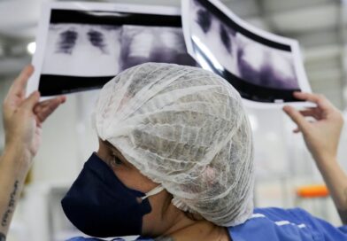 Câncer de pulmão: 15% dos casos acontecem em não fumantes