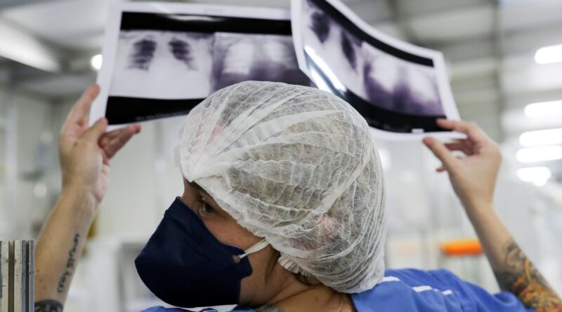 Câncer de pulmão: 15% dos casos acontecem em não fumantes