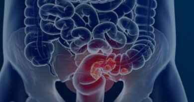 Estudo projeta aumento de 36% em mortes por câncer colorretal até 2040