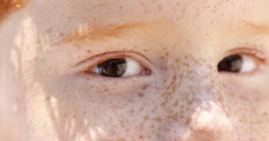 Reflexo branco nos olhos: entenda condição que assusta pais