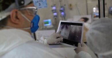 Covid é principal causa de internação por síndrome respiratória no Rio