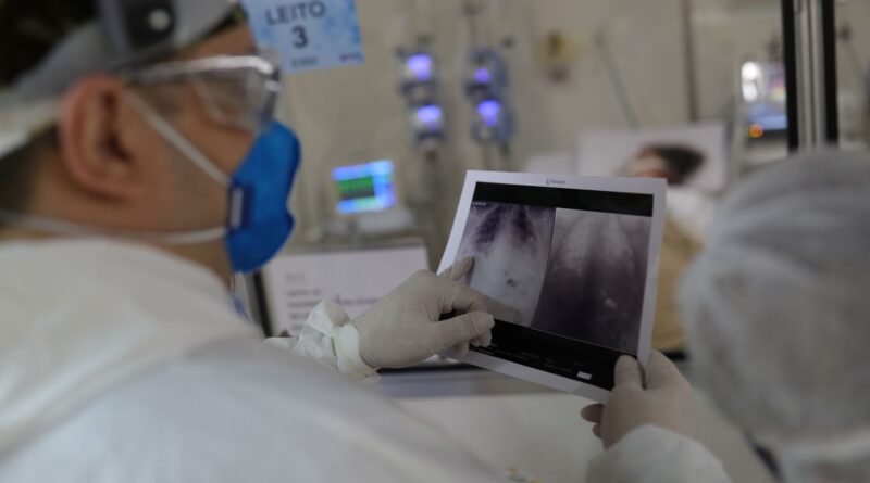 Covid é principal causa de internação por síndrome respiratória no Rio