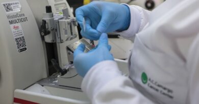 Cura de câncer de próstata pode chegar a até 98% 