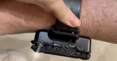 Bolsonaro usou ferro de solda para tentar abrir tornozeleira