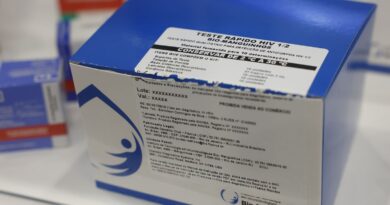 Fiocruz vai ampliar produção de kits diagnósticos para o SUS