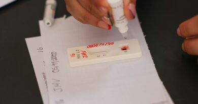 Ação no DF oferece testagem rápida e informação sobre HIV/Aids