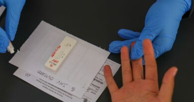 HIV/Aids: Brasil vai insistir em acordo por PrEP de longa duração