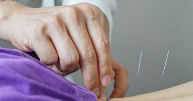 Brasil regulamenta exercício profissional da acupuntura