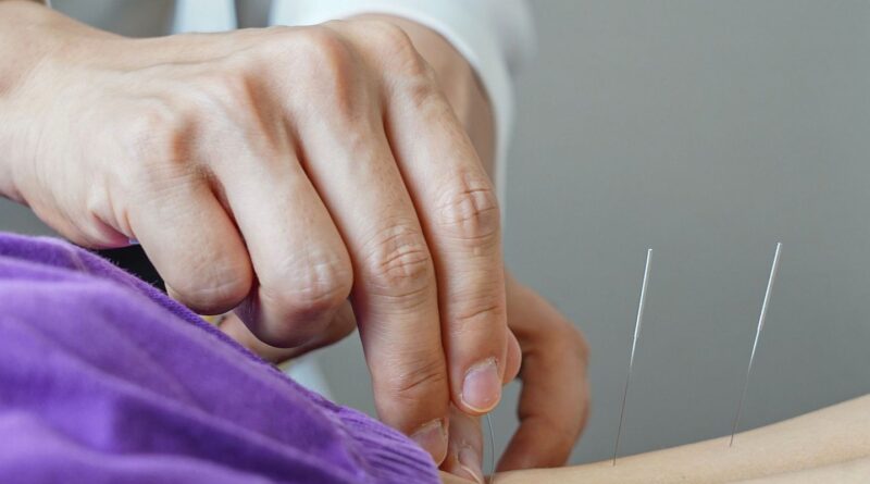 Brasil regulamenta exercício profissional da acupuntura