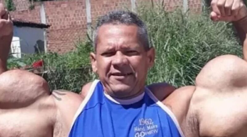 Morre Arlindo de Souza, conhecido como "Popeye Brasileiro"