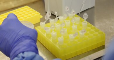 SP confirma segundo caso importado de sarampo