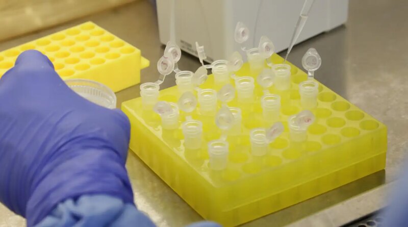 SP confirma segundo caso importado de sarampo