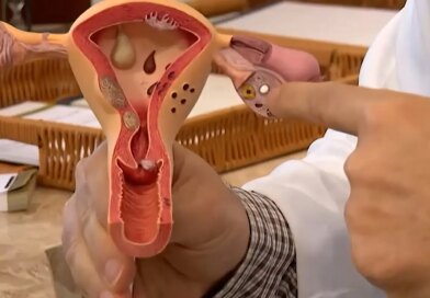 Aberta chamada pública para pesquisas sobre endometriose