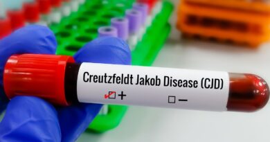 Entenda Doença de Creutzfeldt-Jakob e busca por tratamento