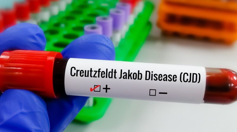 Entenda Doença de Creutzfeldt-Jakob e busca por tratamento